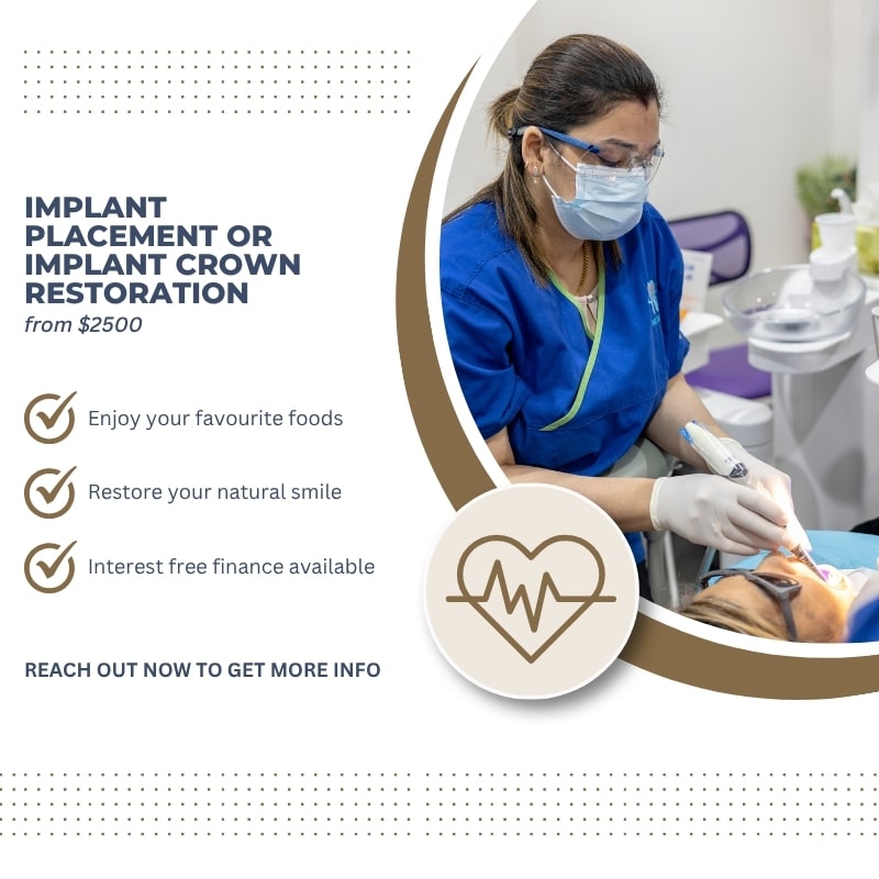 https://highdentalimplantsmelbourne.com.au/wp-content/uploads/2025/10/Implant-Placement-1.jpg