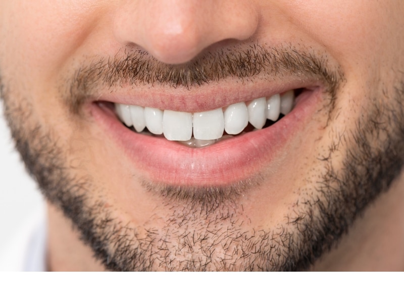 How Do False Teeth Compare to Dental Implants?