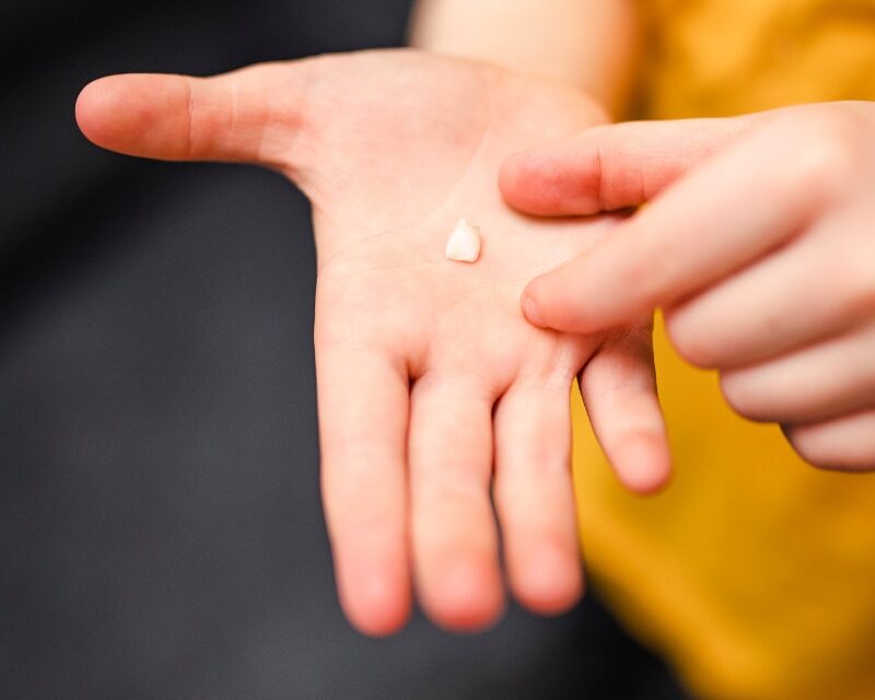 What to Do After You Lose a Tooth: A Melbourne Guide to Your Next Steps